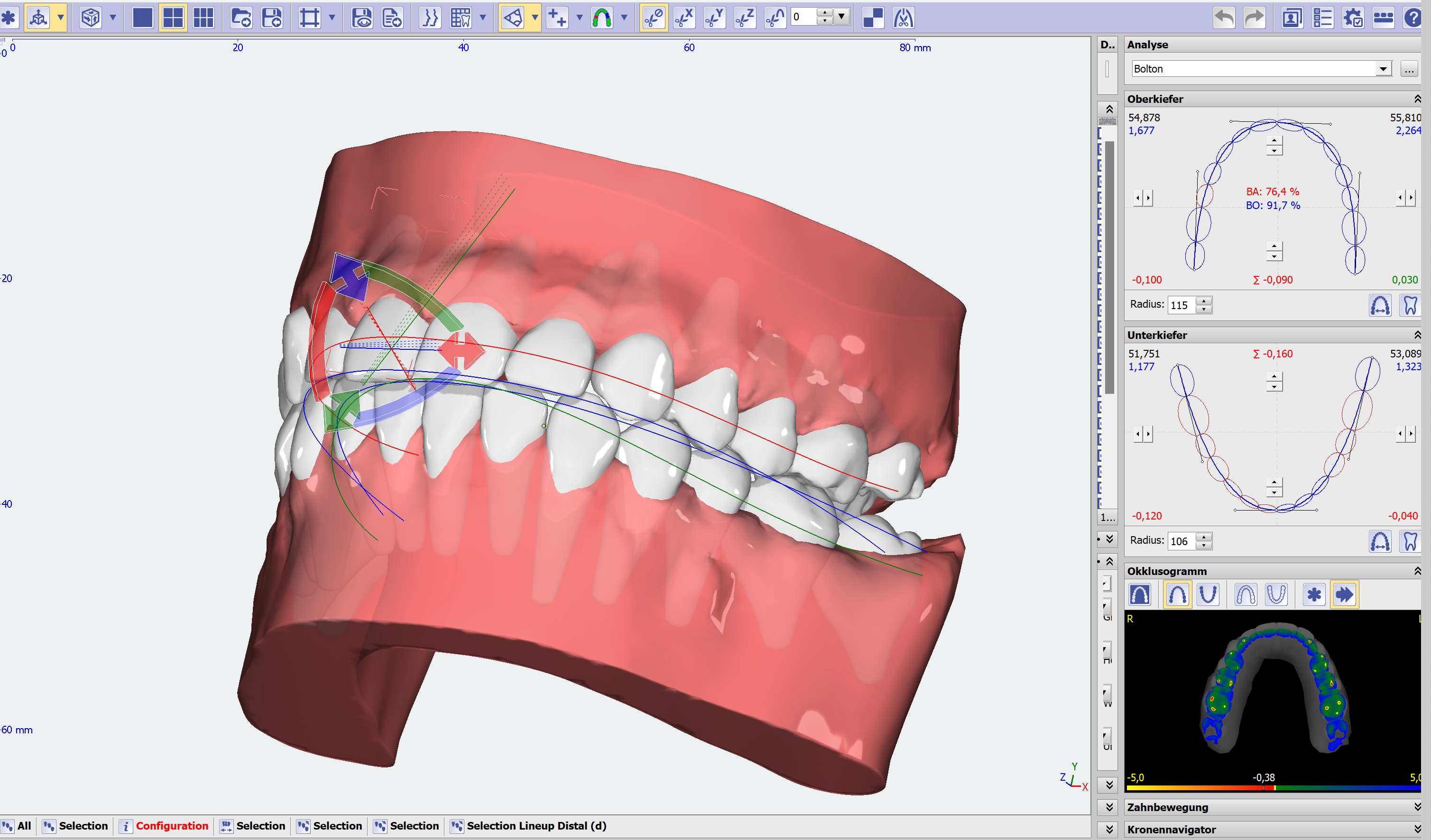 Aligner Planung-1